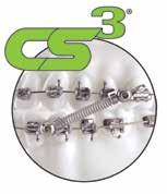 CS3 System The CS3 system is one of the most successful Class II and Class III chairside appliances because of its simplicity, effectiveness and ease of use.