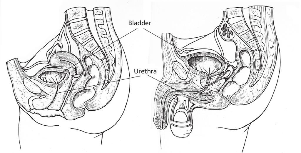Flexible Cystoscopy What is it? This is a procedure to examine your bladder.