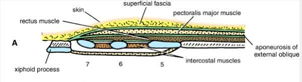 Transverse sections of the rectus sheath