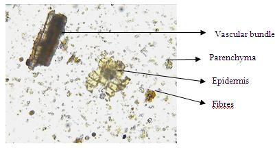 Figure 4: Microscopic examination of powdered drug of Viscum articulatum Burm. f.
