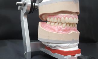 If the A contacts would lie buccal of it, then the positional stability of the lower jaw denture would be particularly at risk on the left side of the patient.