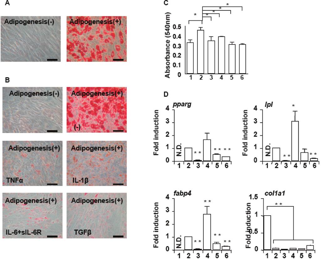 Mesenchymal stromal cell adipogenesis and bone oedema / A. Okada et al. anti-sense primer 5 -TCGTGGAAGTGACGCCTTTC-3 ; human lipoprotein lipase (lpl) (Accession NM_000237.