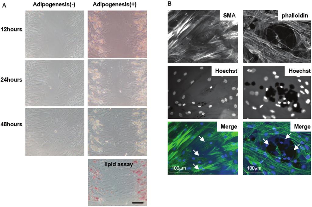Mesenchymal stromal cell adipogenesis and bone oedema / A. Okada et al. Fig. 3. The migration ability of MSCs after adipogenesis.