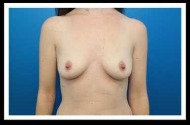 Patient 2 Case Study Patient demographics: 34 year old female with