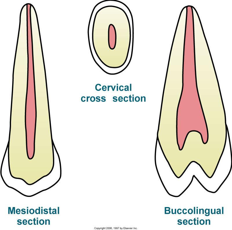 Maxillary Second Premolars #4, #13 Root & Pulp Cavity: usingle root most common with groove on mesial