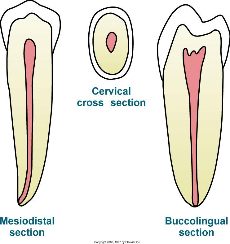 Mandibular Second Premolars Root & Pulp Cavity usingle-rooted udistal root
