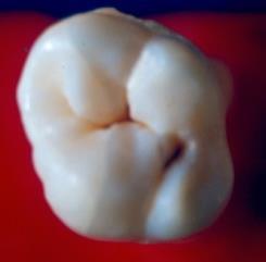 g. Cusp ridge it is the buccal and lingual elevated margins of the occlusal surface of posterior teeth.