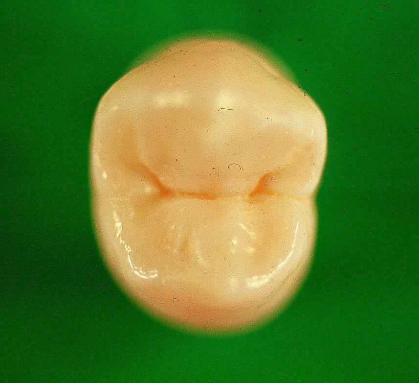 tip of posterior teeth toward the central part of occlusal