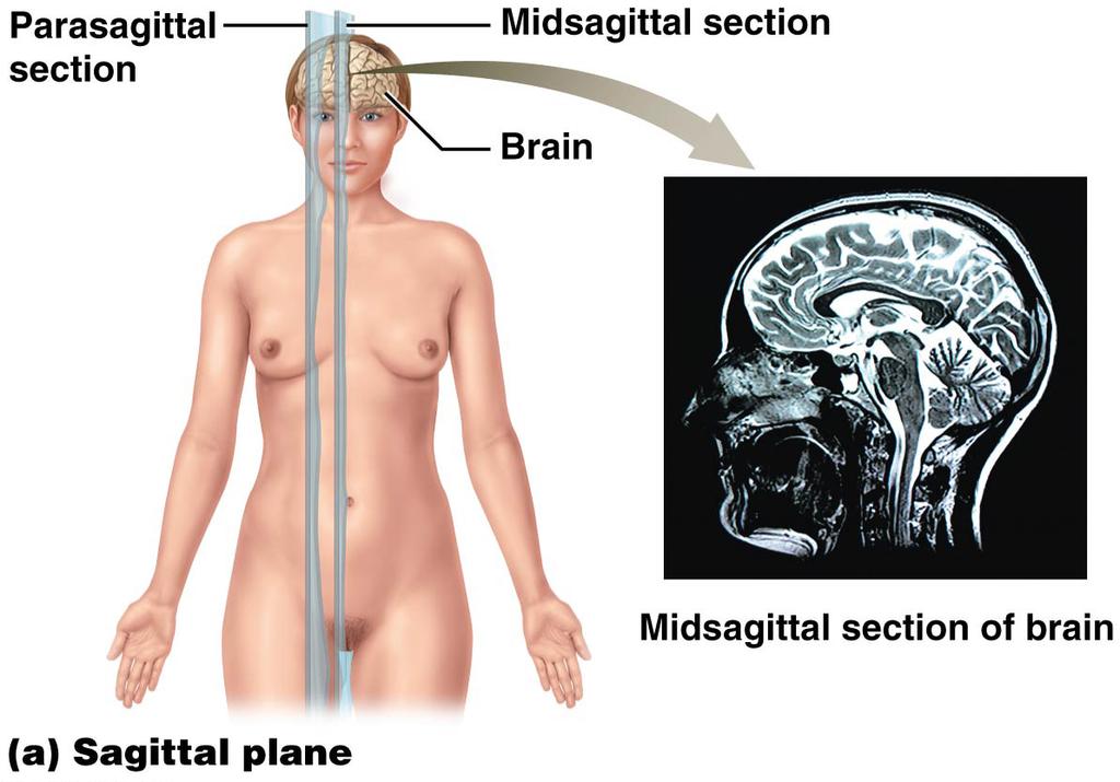 Chapter 1: Intrductin PLANES OF SECTION Sagittal