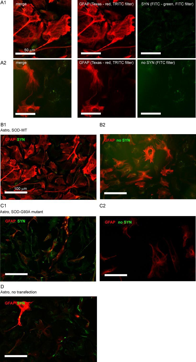 Suppl. figure S4: False colored confocal images of immunofluorescent labeled astrocytes in standard Petri dishes.
