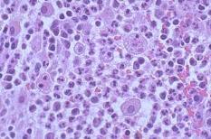 Tissue destruction Macrophages can produce tissue destruction