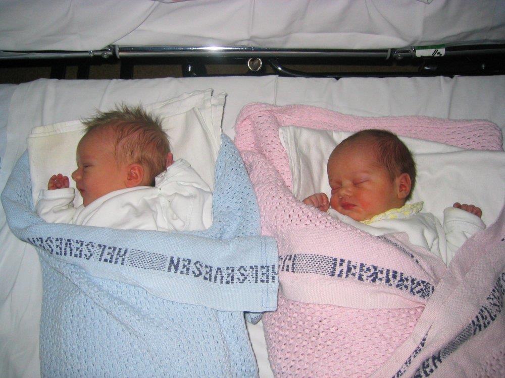 Twins Increased preterm birth, LBW, perinatal mortality,