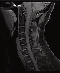 images of the c-spine, Figure 6 illustrates the