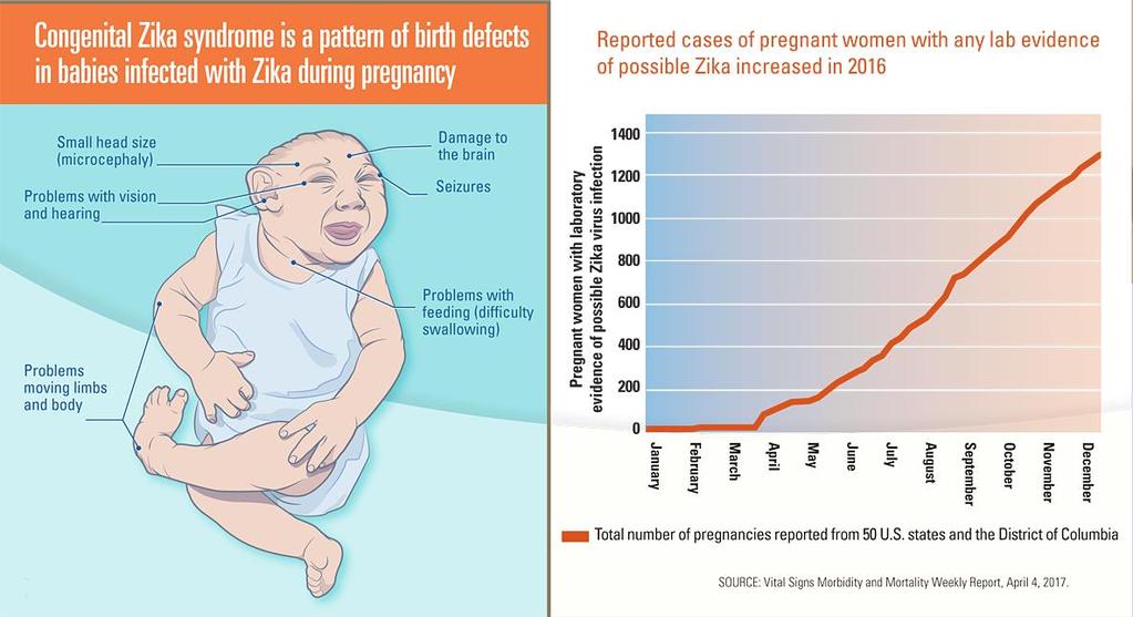 Zika-related Birth Defects 121 of 2,233