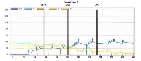 Sensation- Assess sensory threshold in response to rectal balloon distention What the patient is asked to do during the test: - The patient is lying on their left lateral with knees bent at a 90