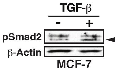 mir-181a promotes Breast Cancer Metastasis Supplemental Figure 1: Taylor et al Supplemental Figure 1 MCF-7 cells were stimulated with TGF-β1 (5 ng/ml) for 30 min.