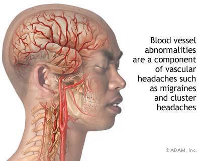 Vascular Pain Migraine and Cluster Headaches Neurovascular