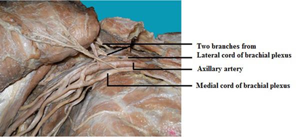 Prakash KG and Saniya K, Anatomical Study of Pectoral Nerves and its Implications in Surgery www.jcdr.