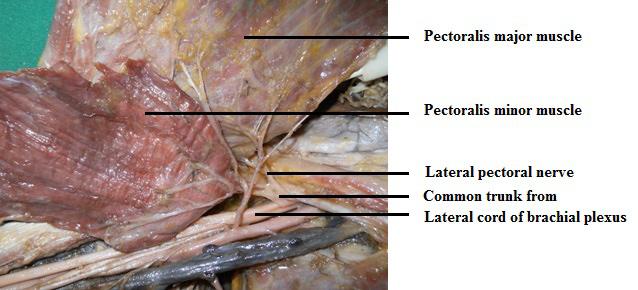 The skin and subcutaneous fat from the entire supraclavicular, infraclavicular and axillary areas had been removed.