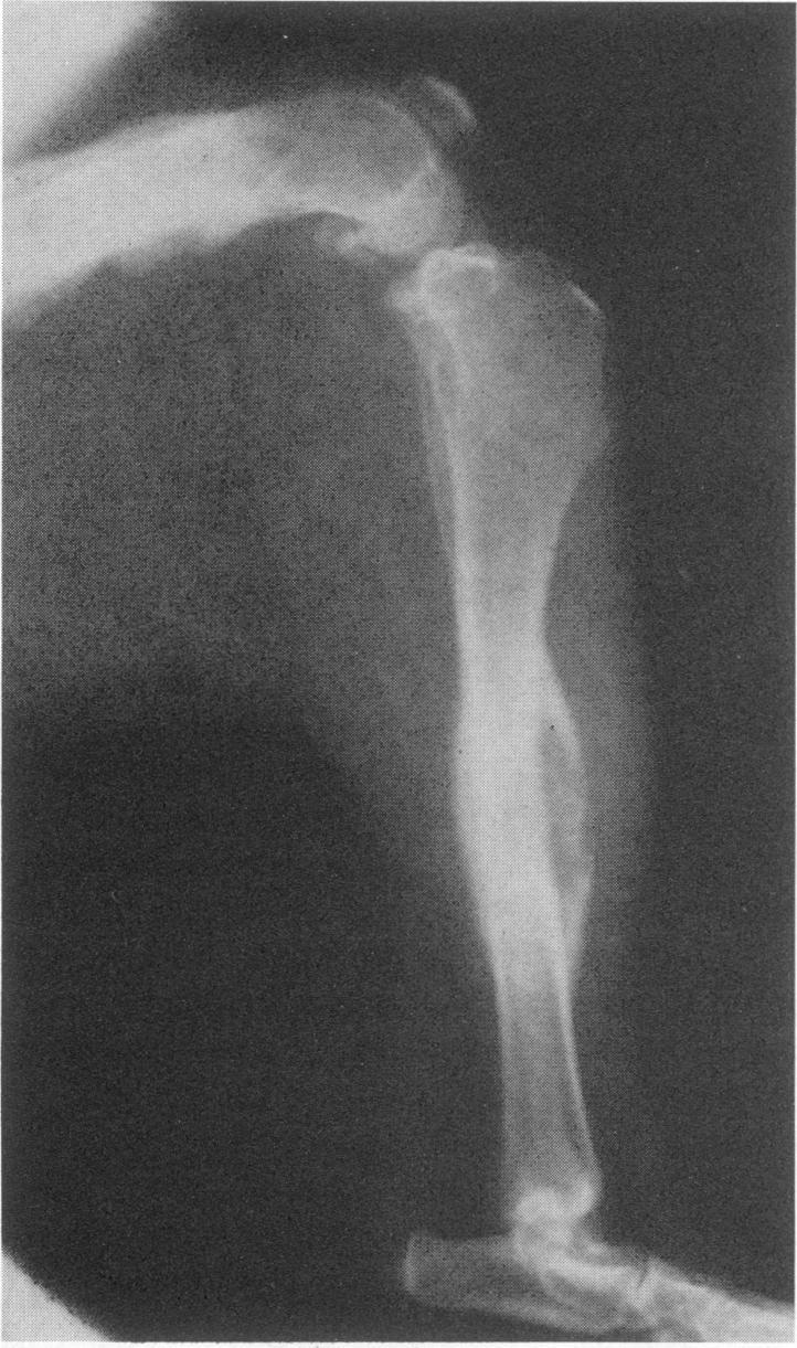 988 NOTES FIG. 1. Lateral view of left tibia and femur.
