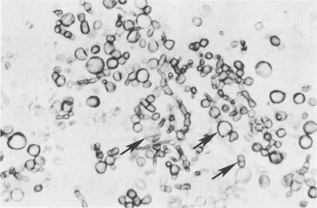 Magnification, x700. in the central areas of the colonies became evident (Fig. 6). The isolate grew at 37 and 40 C.