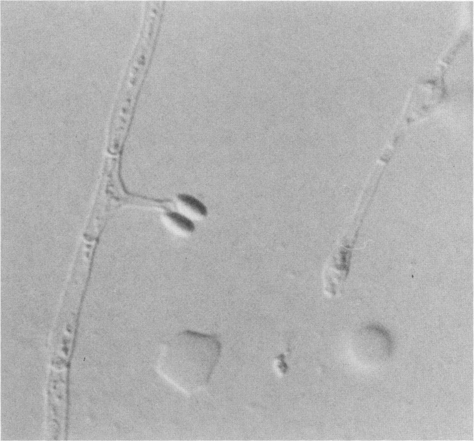 Inset: Replicate section shows positive staining of some elements for melanin with the Fontana-Masson silver procedure. Magnification, x700. hyphae close to the agar surface.