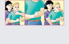 Use Abdominal Thrusts to expel object.