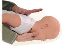 Use a combination of back slaps and the chest-thrust maneuver. Assess the infant s airway and breathing.