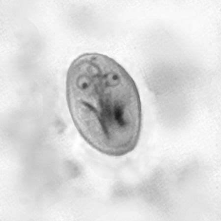 Extent 2 flagging appears for failure to report Giardia lamblia.