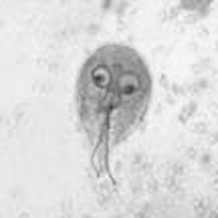 or Parasites found, referred for ID. Very high magnification G. lamblia cyst G. lamblia trophozoite G.