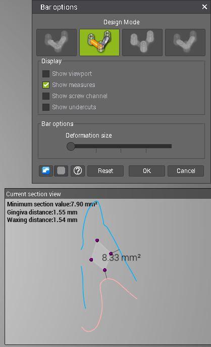 Show Measures When activating the Show Measures button in the 2D Designer, the bar segment lengths and the measured minimum distances