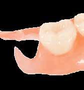 dentition than most chromes and resistant to plaque buildup.