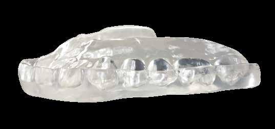 Designed to keep the upper and lower teeth from grinding together, the night guard is