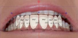 Scale, translate, bend and rotate teeth as a group To scale, translate, bend and rotate the teeth as a
