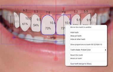 Reshape the tooth by dragging from the blue control points.