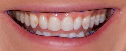 teeth Show Golden proportions ratios Save teeth designs to library Select a colour for each tooth