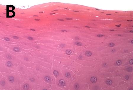 Histological evaluation of the sections by light microscopy revealed a nodular mass of fibrous connective tissue covered by hyperparakeratinized stratified squamous epithelium (Fig. 4).