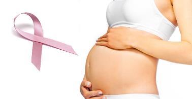 BREAST CANCER DURING PREGNANCY Breast cancer is diagnosed in about 1 in 3,000 pregnant women.