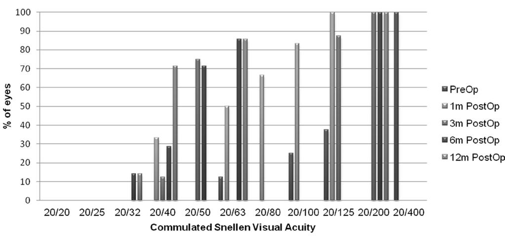 Figure 2. Change in corrected distance visual acuity (CDVA) bar graph (safety). Postop = postoperatively Figure 3.