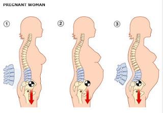 Anatomical Description Pregnancy related low back pain is a common complaint that occurs in 60-70% of pregnancies and can be defined as pain between the 12th rib and the gluteal folds/pubic symphysis