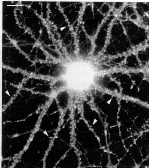 Hippocampal neuron stained for