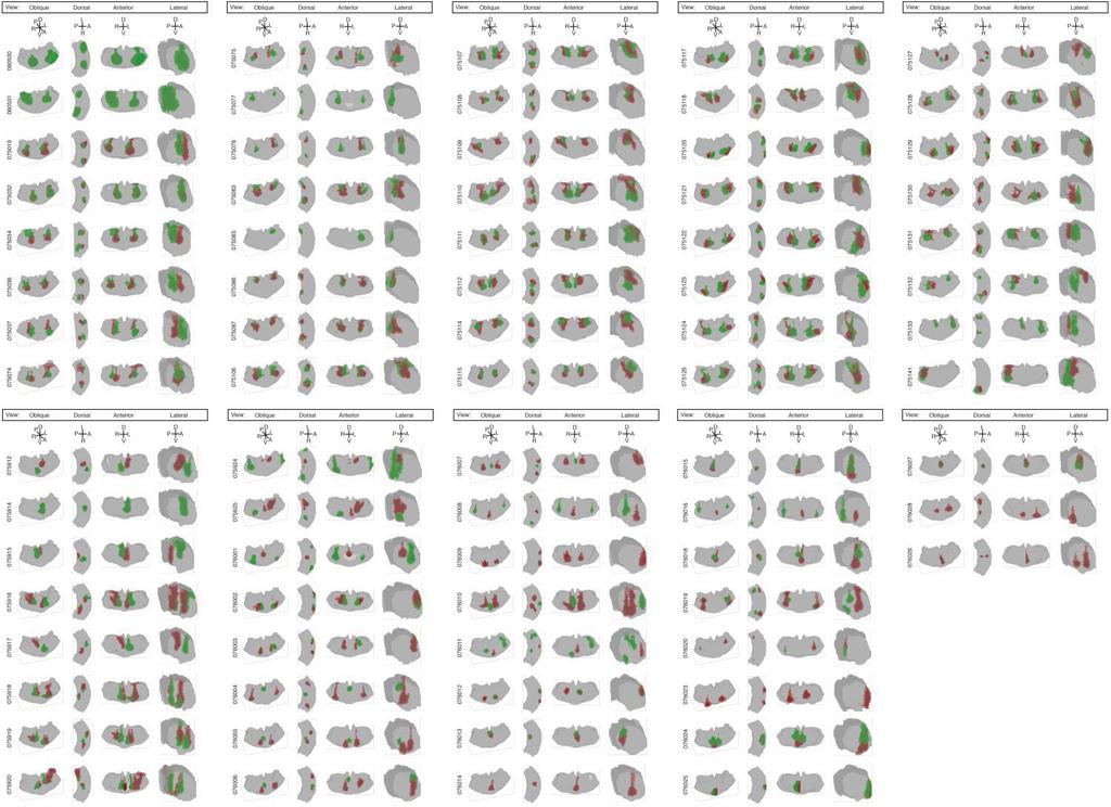 Supplementary Figure 4 3D rendering of the thalami and corresponding viral injections of all 75 experimental brains.