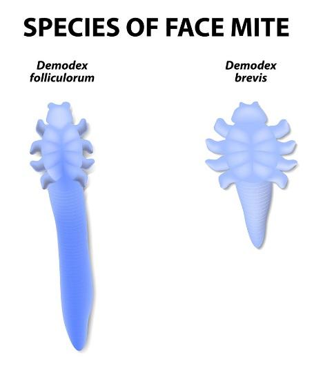 Chapter 2: Eye Mites? Gross! What are They? And What Do They Do? There are two species of mites which can infest human eyelids, both from the genus Demodex: D. folliculorum and D.