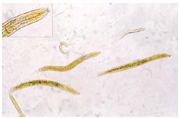 Iranian J Parasitol: Vol. 3, No. 3, 2008, pp. 42-47 culture, various stages of larvae, female worms and eggs were recovered (Fig. 2).