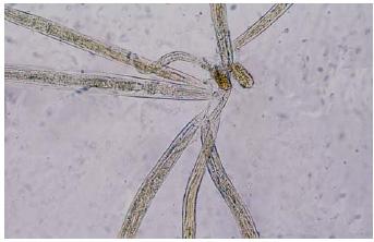 A Athari et al: Diploscapter coronata Infection in Iran Fig.2: D. coronata eggs and rhabditiform larvae in culture. X 400 Fig.3: D. coronata adult female rhabditiform nematodes measuring 3.1-4.