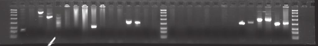r La d T N T N T N T N T N T N T N T N de de La d La d de r r PCR validations of pseudogenes identified by bioinformatics algorithm T N T N T N T N T N T N T N Germline pseudogene Example of a