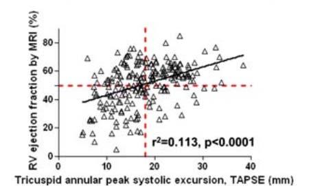 Correlation between RV EF (CMR) and TAPSE (Echo) RV ejection fraction by MRI (%) 80 60 40 20 0 0 r 2 =0.113, p<0.