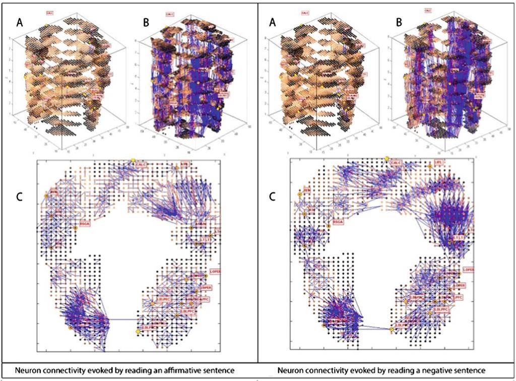 Dynamic 3D Clustering of Spatio-Temporal Brain Data 195 Fig. 2.
