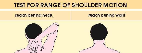 Relatively subtle limitation of motion of the shoulder joint can easily be detected.