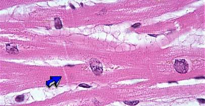 Cardiac Muscle Histology Branching cells Intercalated disc: contains many gap junctions